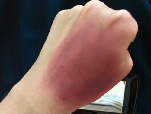 痣(あざ)メイクの簡単な作り方と必要なものは?手順をわかりやすく!